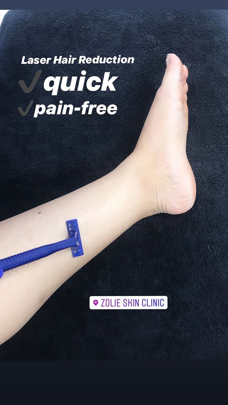 Laser Hair Reduction Procedure